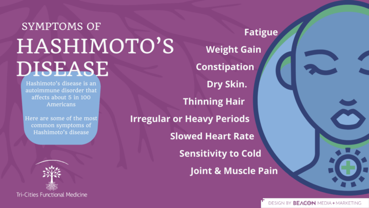 Autoimmune Thyroid Disorders: What Is Hashimoto’s Disease?